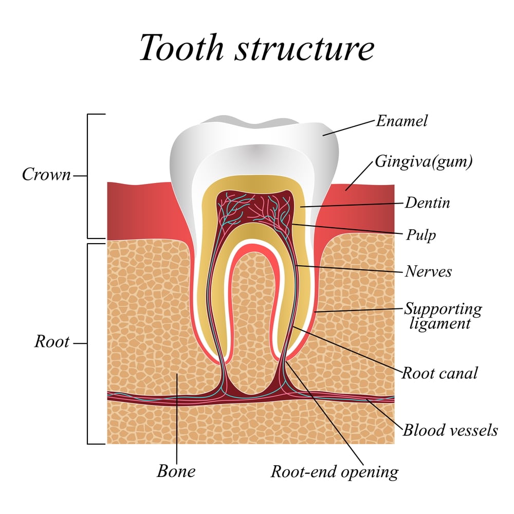 Dental implant